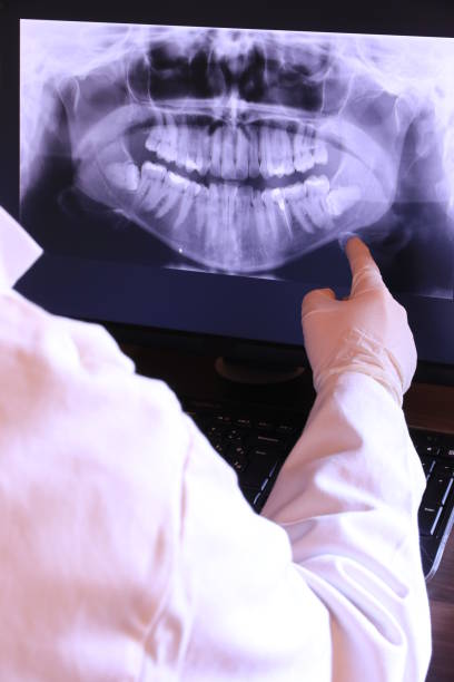 Best Emergency Treatment for Dental Infections or Abscesses in Staples, MN
