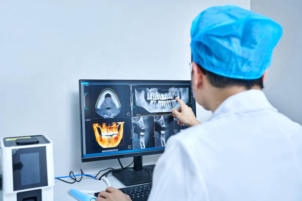 Best Emergency Root Canal Treatment in Staples, MN
