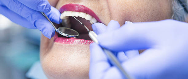 Best Emergency Tooth Extraction in Staples, MN